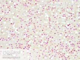 HC-10#圆透明七彩